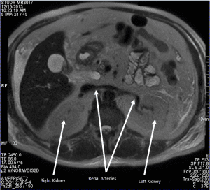 ABCs-MRI-Figure8b