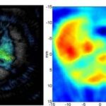 Hybrid Imaging Advances Optical, Ultrasonic Imaging