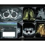 Synapse VNA Offers Scalable Content Management Solution for Patient Data