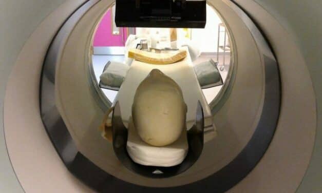 Researchers Improve Brain Imaging with Kinect Video Gaming System