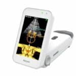 Handheld Ultrasound Device with 3D Navigation Earns FDA Clearance