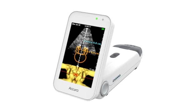 Rivanna Begins Sales of Its Accuro Handheld Ultrasound Device