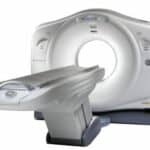 FDA-cleared Low Dose CT Lung Cancer Screening Enables Early Detection