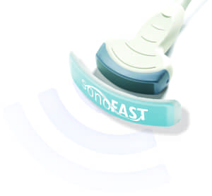 SonoFAST Ultrasound-coupling Technology Platform