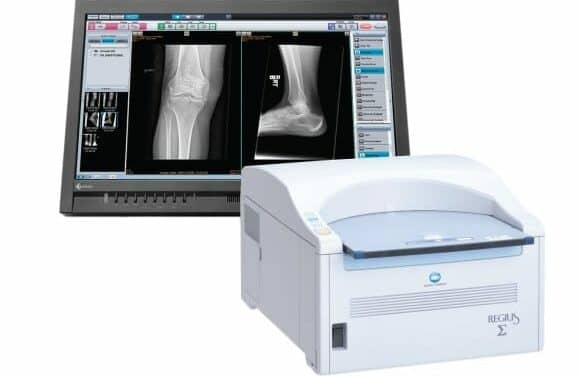 Konica Minolta Launches CR System with Low-Cost Upgrade Path to DR