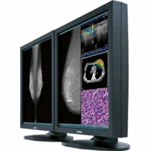 Totoku color display for digital mammography