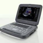 Siemens Portable Ultrasound System Handles High-volume Imaging