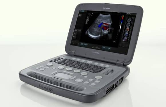 Siemens Portable Ultrasound System Handles High-volume Imaging