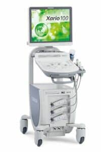 Toshiba Xario 100 ultrasound