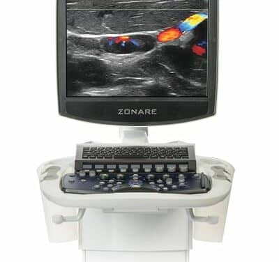 Zone Sonography Technology Helps Physicians Improve Diagnostics