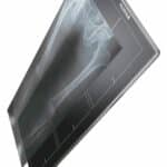 Fujifilm Unveils Long-length DR Detector at RSNA 2015 Meeting