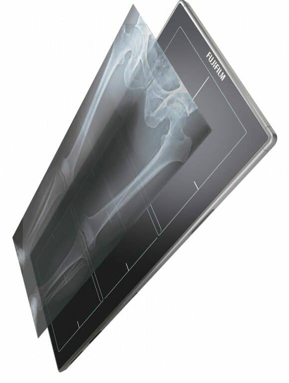 Fujifilm Unveils Long-length DR Detector at RSNA 2015 Meeting