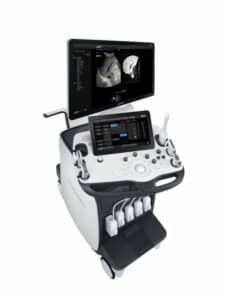 Samsung RS80A with Prestige ultrasound system