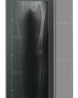 Fujifilm Unveils New DR Technology to Orthopedists