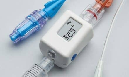 Digital Pressure Monitor Expedites Assessment of Sepsis