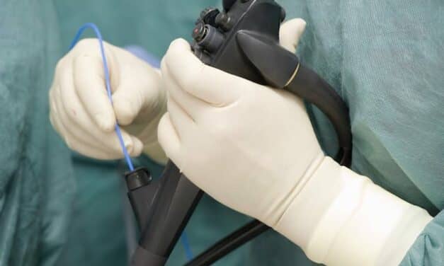 Endoscopy Equipment Market Worth $35.36 Billion by 2021