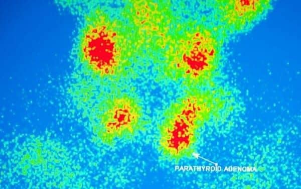Global Nuclear Imaging Market Slated to Grow 6% by 2021