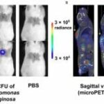 New PET Tracer Can Identify Bacterial Infections
