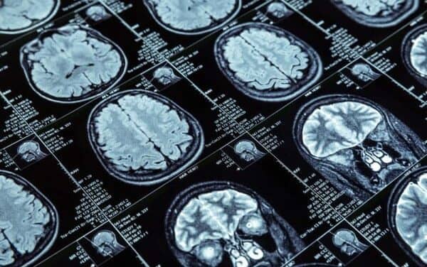 An Inside Look at Medical Imaging