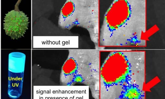 Molecular Gel Aids in Cancer Image Mapping