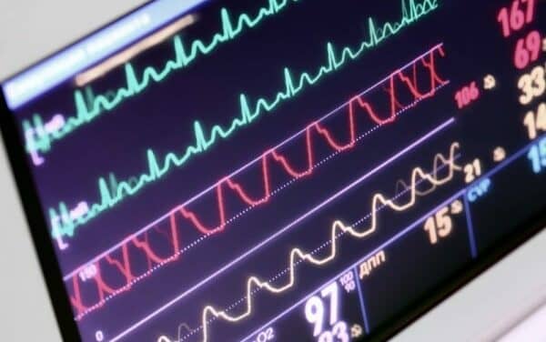 Adventist’s Gordon Hospital Deploys Advance ICU Care’s Remote Telemetry System