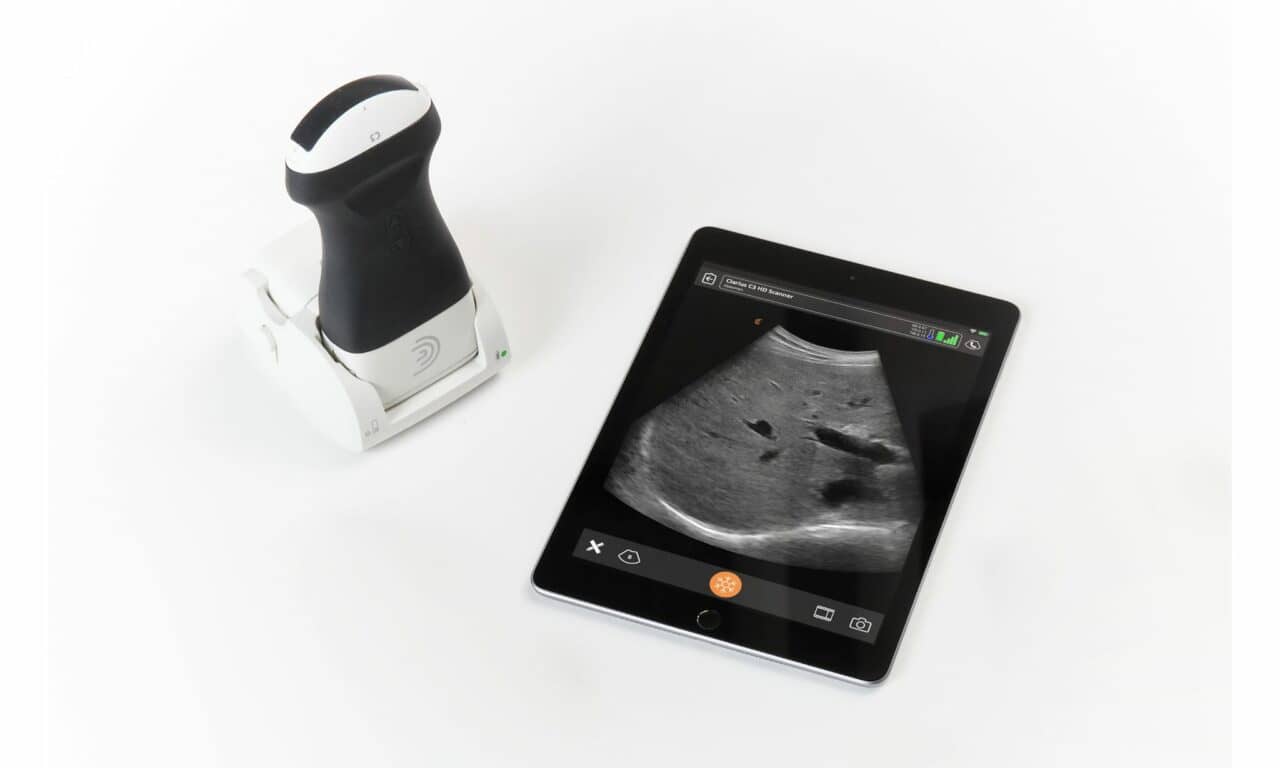 Clarius Releases 2-in-1 Charging Station for Handheld Ultrasound