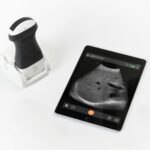 Clarius Releases 2-in-1 Charging Station for Handheld Ultrasound