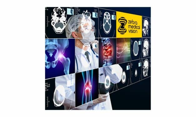 Zebra Medical Vision Gets FDA Clearance for AI 3D Bone Modeling Solution