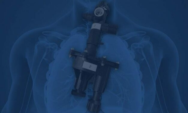 Researchers Detail RapidVent Emergency Ventilator Production