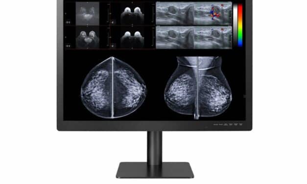 Double Black Imaging Expands PACS and Breast Imaging Display Solutions with 12MP Display