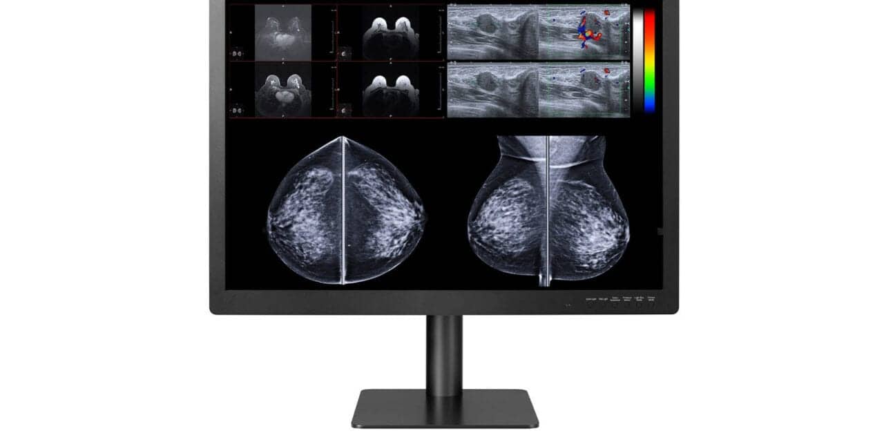 Double Black Imaging Expands PACS and Breast Imaging Display Solutions with 12MP Display