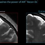 FDA Clears GE Healthcare AI MRI Technology