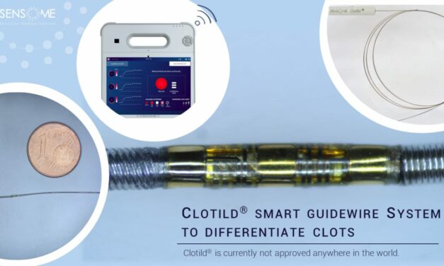 Sensome AI-Powered Stroke Guidewire Gets FDA Breakthrough Device Designation
