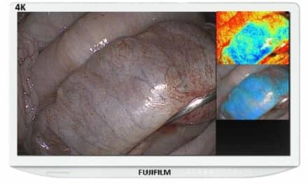 FDA Clears Fujifilm’s Endosurgical Image Enhancement Technology for Eluxeo Surgical System