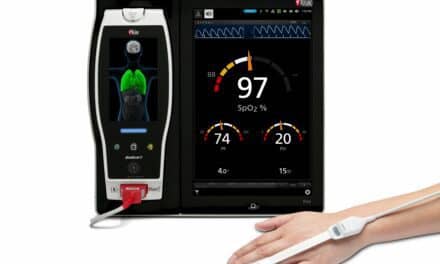 Study Evaluates Use of Masimo PVi to Monitor Volume Status in Hemodialysis Patients