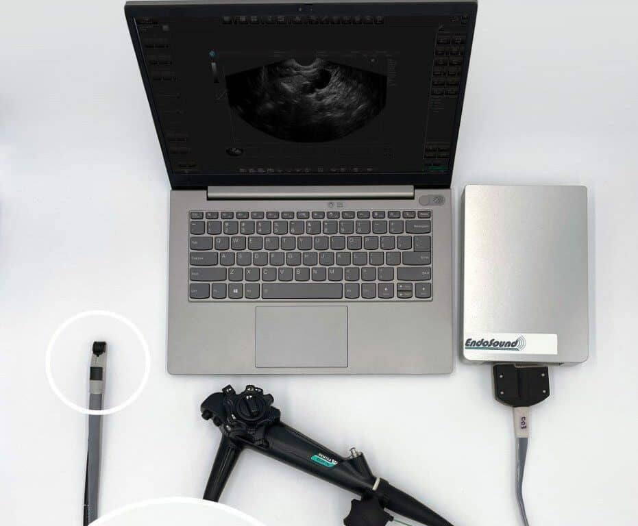 U.S. FDA Grants Breakthrough Device Designation for EndoSound Vision Ultrasound System