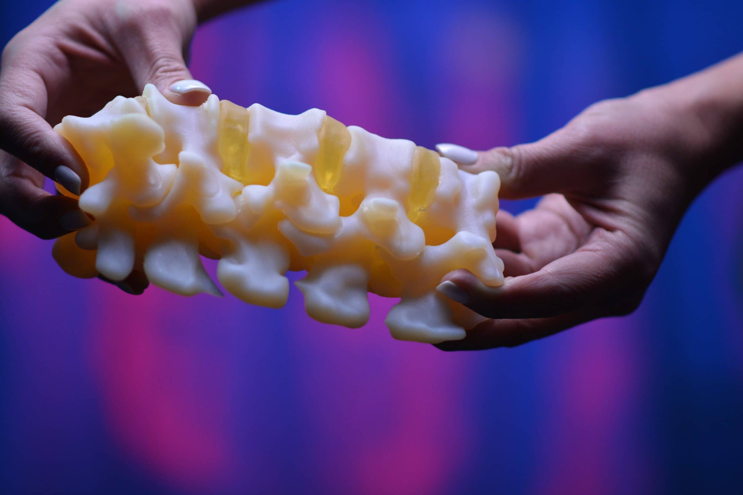 Stratasys, Ricoh Partner to Provide 3DPrinted Anatomic Modeling 24x7