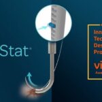 DuraStat Gets Vizient Innovative Technology Contract for Dural Repair Device