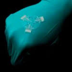 ‘Smart’ Bandages Monitor Wounds and Provide Targeted Treatment