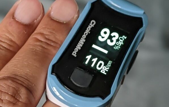 Study: Bias from Pulse Oximeters Remains Even If Corrected by Race