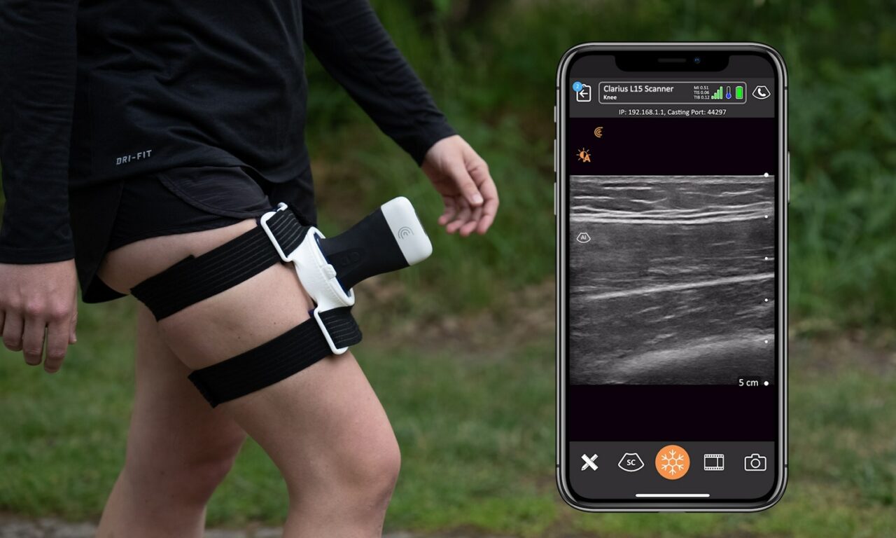 Clarius Introduces Mobile Ultrasound Imaging Solution