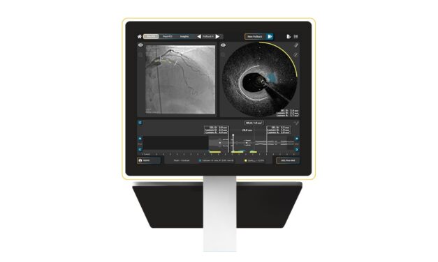 FDA Clears SpectraWAVE HyperVue Enhancements