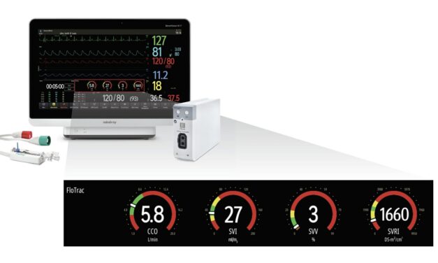 Mindray Announces New Integration with Edwards FloTrac Sensor