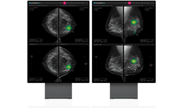 FDA Clears Lunit Insight DBT
