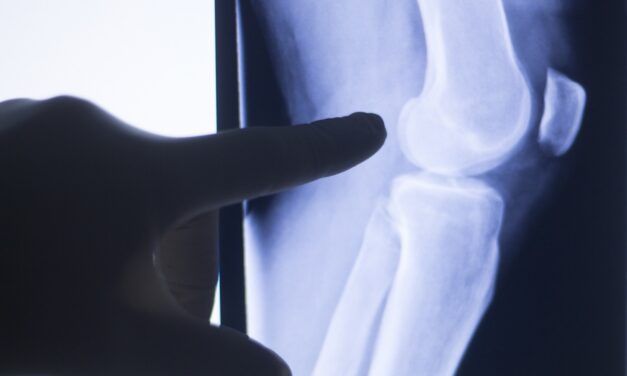 Enhatch AI-Driven Knee Surgery Solution Receives FDA Clearance