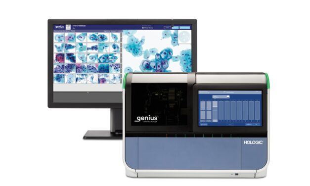 FDA Clears Hologic’s Genius Digital Diagnostics System
