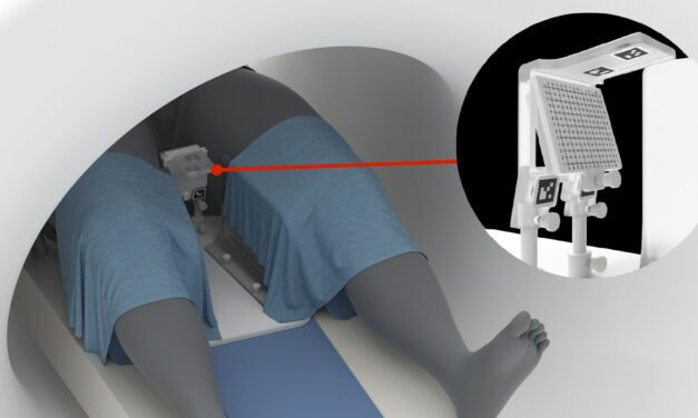 Clear Guide Scenergy Earns FDA Clearance