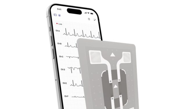 WearLinq Acquires AMI Cardiac Monitoring