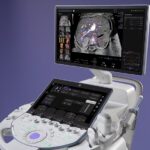 FDA OKs GE HealthCare Voluson Expert Ultrasound Systems