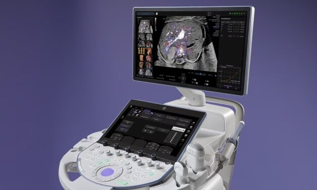 FDA OKs GE HealthCare Voluson Expert Ultrasound Systems